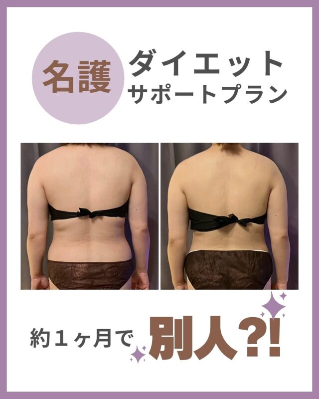 .
┏━━━━━━━━━━┓
ダイエットサポートプラン
┗━━━━━━━━━━┛  6月に体験ご予約からスタートされたお客さま
お身体どんどん変化してきています!!💪🏼❤️‍🔥  お仕事上、リズムが掴めるかドキドキでしたが
ご自身でも工夫しながらダイエット感覚を
しっかりと掴んでいます♩💯  体重や体脂肪数値に表れると
どんどんやる気🔥がUPしますね⸝⋆ᵕ̈*  個々の生活スタイルに合わせて
日々の習慣を無理なく変えていく方法を
サポート📝☺︎  ３ヶ月　6回コース or １０回コース
ご用意してます。  今月スタートされると
秋🍂には史上最高の自分に出会えるカモ?!  あなたの『変わりたい』心
お待ちしております❤️‍🔥  まずは体験ご予約から♩
@cocorebeau_nago  トップの予約サイト１番下にある
【ダイエットサポート体験】予約から
お進みくださいませ📝  #沖縄 #名護 #マッサージ #ダイエット