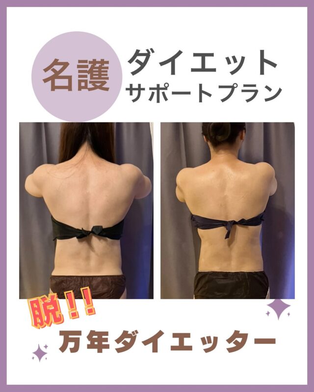 .
✨隠す服より、魅せたくなる体へ✨  何を着ても「着痩せ」狙い
昔みたいに
ちょっとやそっとじゃ体重落ちない
気づけば何度目かのリバウンド…  そんな《万年ダイエッター》のあなたへ
📣【体質ケア×マッサージ×習慣サポート】で
「周りから“痩せた？”って言われる自分」に  #リバウンドを繰り返してきた方
#食事制限も運動も続かない方
#着たい服より着られる服を選んでいる方  💆‍♀️そんな女性たちをサポートするのが
＼マッサージダイエットサポートコース／  老廃物を流して代謝をUP
固くなった脂肪にアプローチ
整った体は、努力の手応えを早く感じやすい✨  ✔️体重が落ちにくくなった
✔️でも、もう諦めたくない
✔️自分の体、ちゃんと向き合いたい  そんなあなたの“本気スイッチ”、
ここでいっしょに押しませんか？🕊️  ⸻
プロフィールTop @cocorebeau_nago 
のリンク🔗予約サイトより
【ダイエットサポート体験】からご予約ください📩  #名護 #名護マッサージ #ダイエットサポート
#沖縄