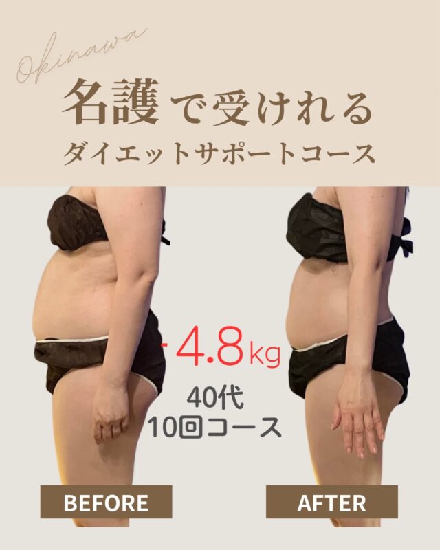 ______⸝⋆  仕事に追われて、
帰りが遅くなって、
気づけば「自分のことは後回し」。  ✔ 夕食はパスタでサッと済ませる
✔ デスクワークで体はガチガチ
✔ 何度もダイエットに失敗  それでも——
体はちゃんと変われます。  こちらのお客様も、
忙しさは変えずに
「巡りを整えるケア」と
「無理のない食事管理」を続けた結果、
10回のサポートでここまでの変化を✨  📍 名護市
月2回のご来店＋日常のちょっとした選択の積み重ね。
完璧じゃなくていい。
“できることから”で大丈夫。  「私も変わりたい」
そう感じた方へ。  ＼ ダイエットサポート10回コース ／
✪ モニター募集：限定1名さま ✪  ✔ 忙しくても痩せたい
✔ 一人では続かなかった
✔ プロに伴走してほしい  そんな方は、
プロフィールリンクの【体験予約】からご予約ください!!
モニターが気になる方は
「モニター希望」と記載くださいね💌  体は、正しく整えれば必ず応えてくれます。